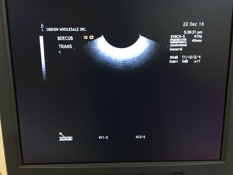 Siemens Sequoia Acuson 512 Cardiac Ultrasound w/ 4V1 6C2 EV-8C4 Transducer DIAGNOSTIC ULTRASOUND MACHINES FOR SALE