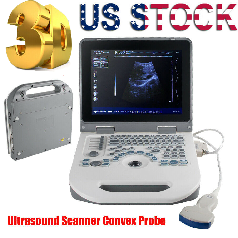 Notebook Digital Laptop Ultrasound Scanner Diagnostic System 3.5MHz Convex+3D DIAGNOSTIC ULTRASOUND MACHINES FOR SALE