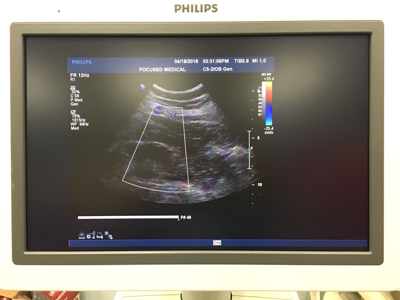 Phillips ATL C5-2 Ultrasound Probe / Transducer Demo Conditions DIAGNOSTIC ULTRASOUND MACHINES FOR SALE