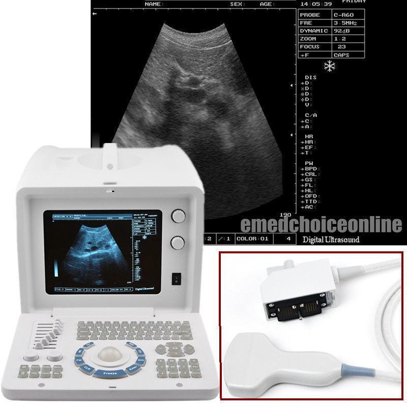 Ultrasound Ultrasound Scanner + 7.5Mhz Linear Probe/Sensor + Free 3D Worksation 190891245212 DIAGNOSTIC ULTRASOUND MACHINES FOR SALE