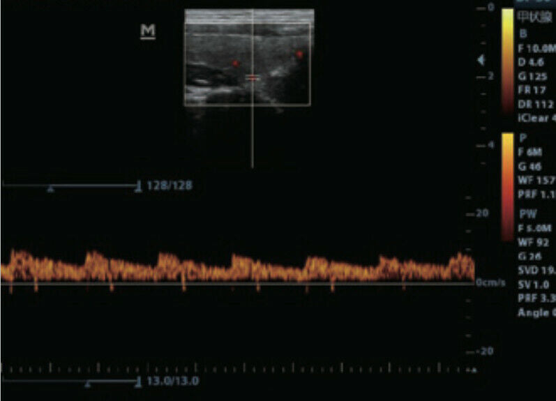 Most Affordable Vet Color Doppler Ultrasound W/ Three Probes, LED,THI, PW DIAGNOSTIC ULTRASOUND MACHINES FOR SALE