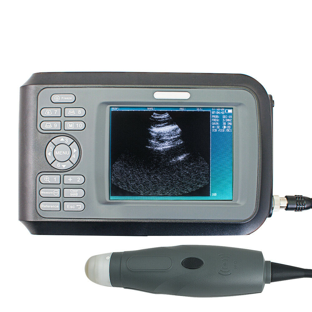 VET Digital Ultrasound Scanner Handheld Machine 3.5MHz Mechanical Sector Probe DIAGNOSTIC ULTRASOUND MACHINES FOR SALE