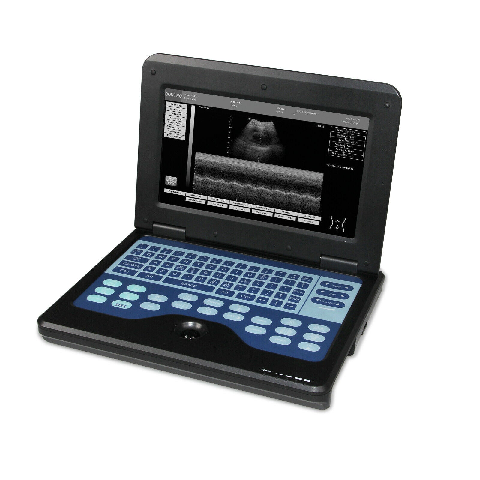 Digital Portable Ultrasound Scanner Diagnostic Machine 2 Probes Convex/Linear US DIAGNOSTIC ULTRASOUND MACHINES FOR SALE