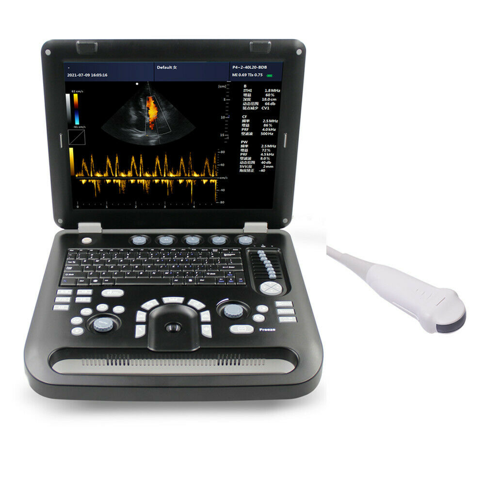 Portable Ultrasound Scanner Color Doppler Cardiac Machine+ Probe Micro-Convex PW 6945040100362 DIAGNOSTIC ULTRASOUND MACHINES FOR SALE