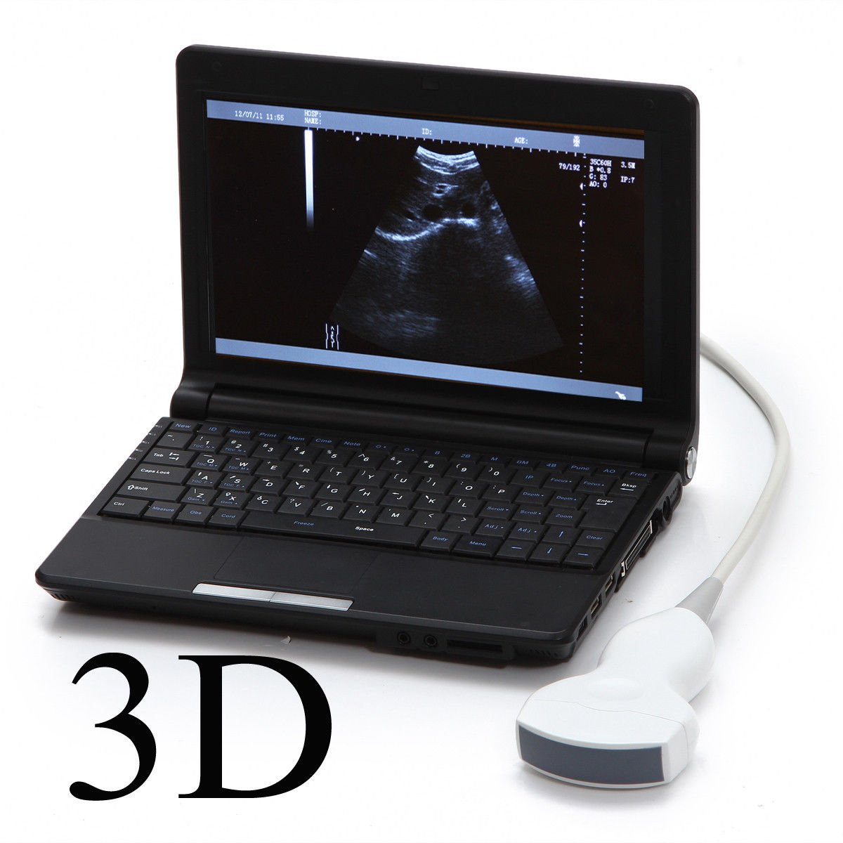 LCD Digital Notebook Ultrasound Scanner with 3.5 MHZ Convex Probe External 3D 190891998767 DIAGNOSTIC ULTRASOUND MACHINES FOR SALE