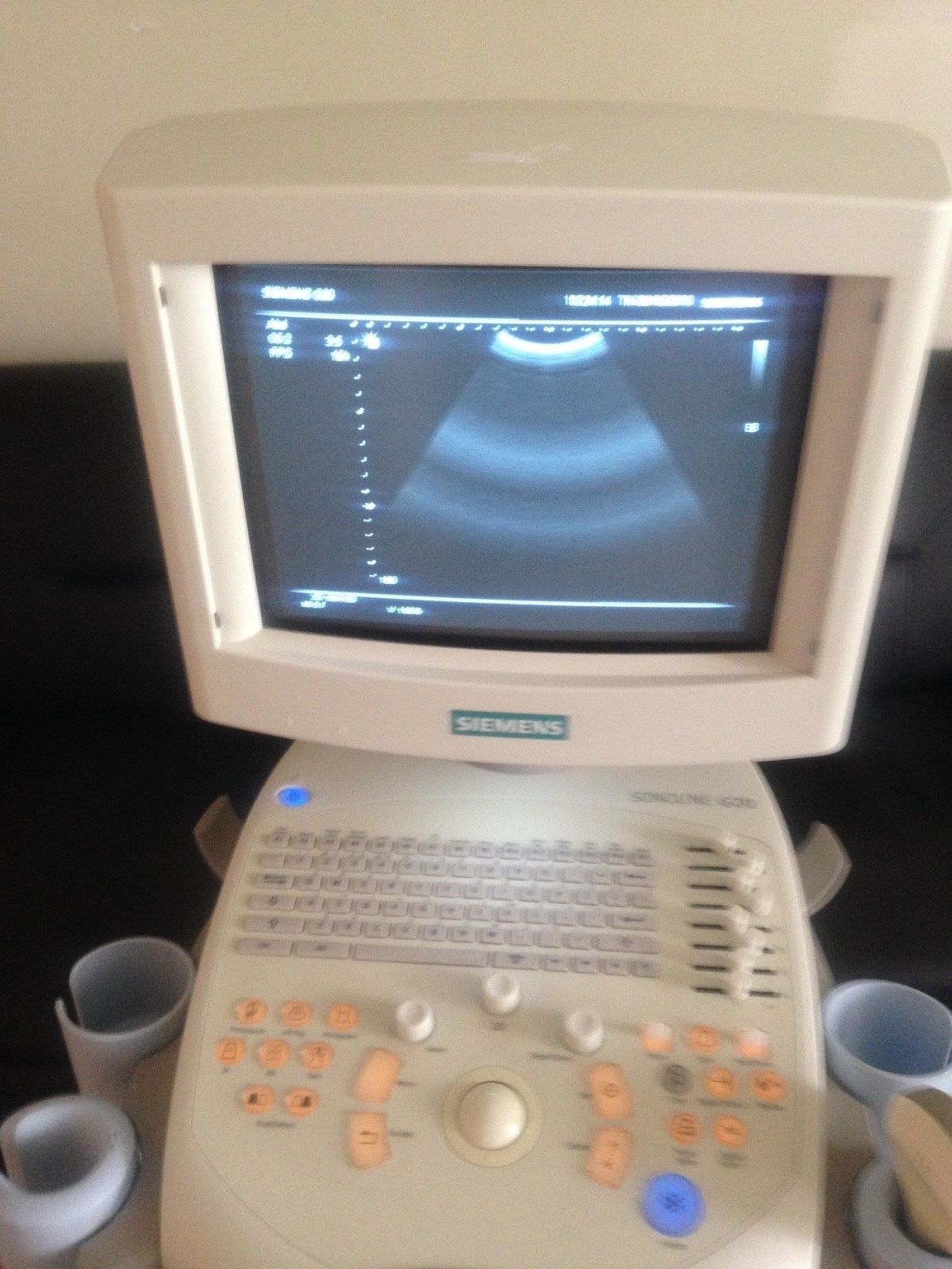 Siemens Sonoline G20 Ultrasound  C5-2 Probe  & Printer  OB-GYN, Urology DIAGNOSTIC ULTRASOUND MACHINES FOR SALE