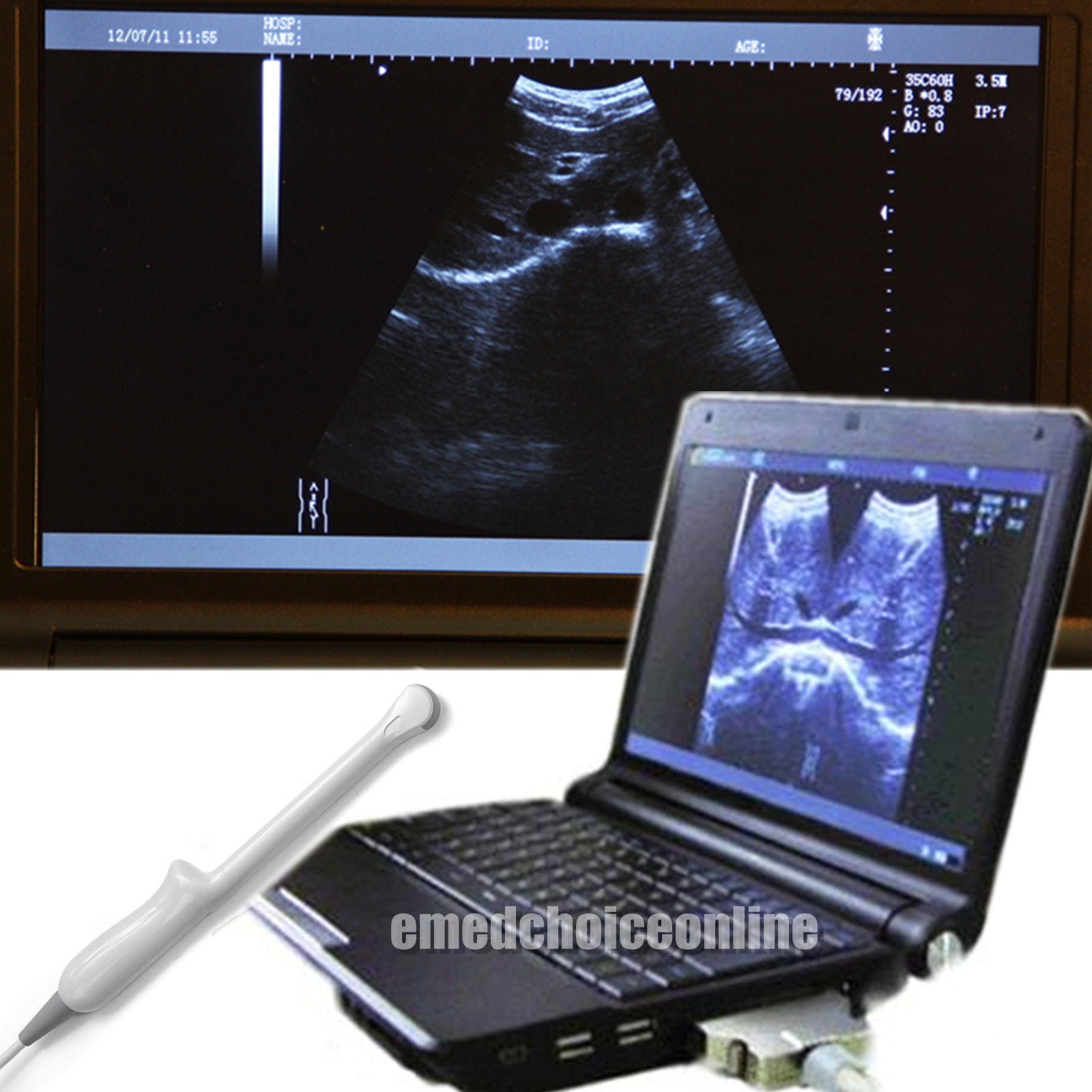 Top Notebook Ultrasound Scanner system Transvaginal probe + Newest 3D image Fast DIAGNOSTIC ULTRASOUND MACHINES FOR SALE