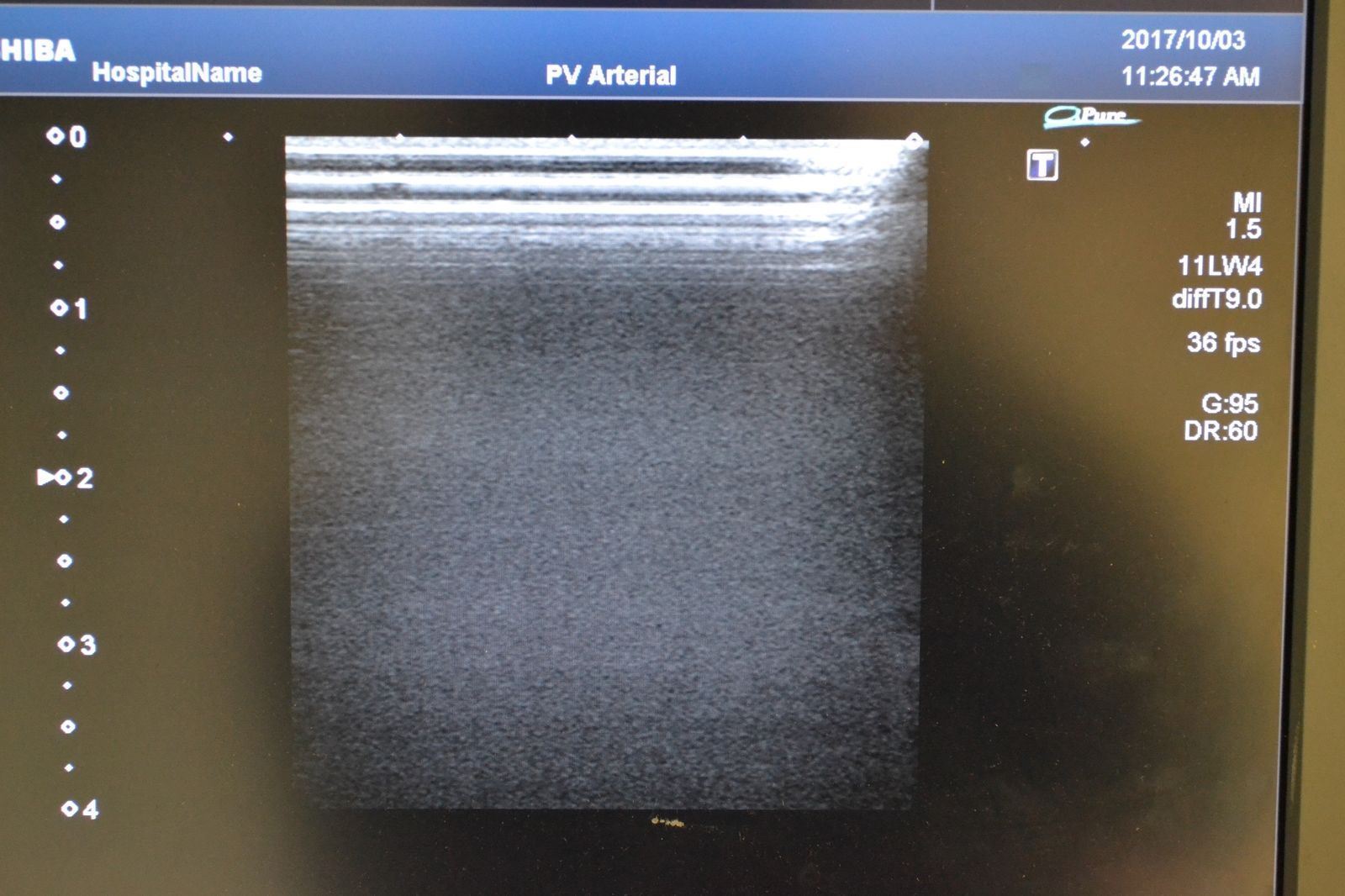 Toshiba Artida PLT-704SBT 11-4.8MHz Linear Ultrasound Transducer Probe  J1627 DIAGNOSTIC ULTRASOUND MACHINES FOR SALE