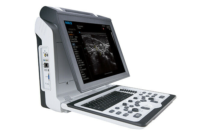 Portable OB/GYN Ultrasound Machine SIUI Apogee 2300 w/2 Probes (DICOM) (NEW) DIAGNOSTIC ULTRASOUND MACHINES FOR SALE