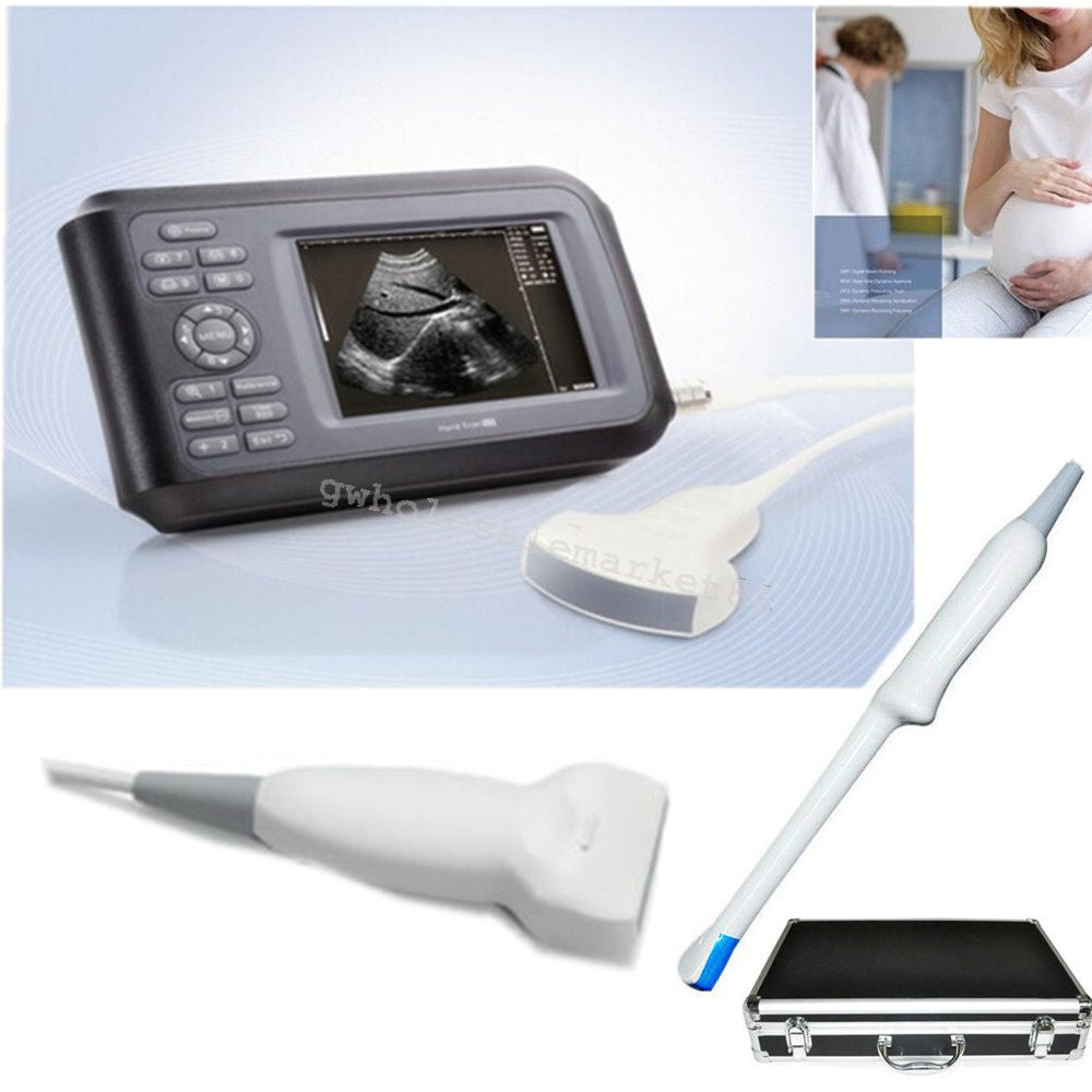 Laptop Machine Scan Digital Ultrasound Scanner Convex Linear Transvaginal Probe DIAGNOSTIC ULTRASOUND MACHINES FOR SALE