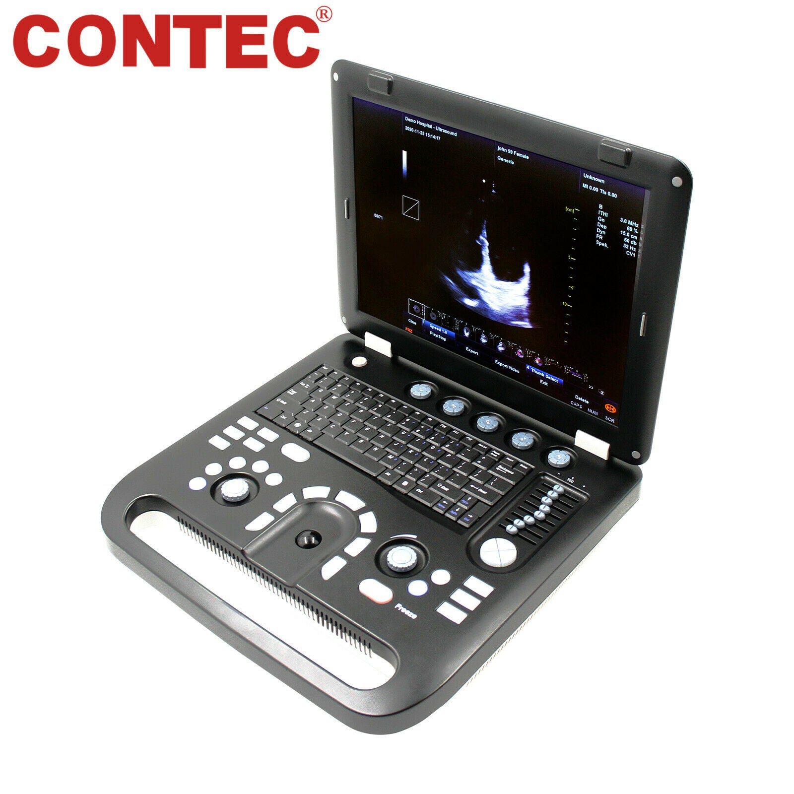 Portable Ultrasound Scanner Color Doppler Cardiac Machine+ Probe Micro-Convex PW 6945040100362 DIAGNOSTIC ULTRASOUND MACHINES FOR SALE