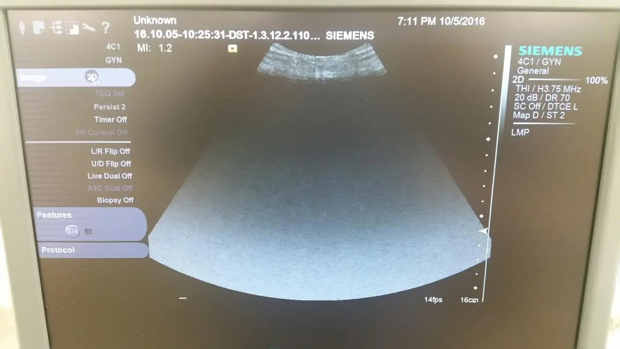 Siemens S2000 Ultrasound Machine with 4C1 and EV-8c4 Transducer Probes DIAGNOSTIC ULTRASOUND MACHINES FOR SALE