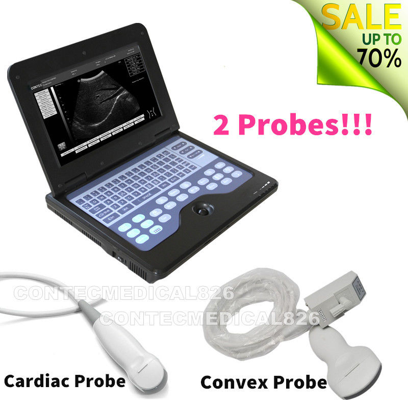 CE Portable Ultrasound Scanner Laptop Machine Diagnostic System Optional 4 Probe DIAGNOSTIC ULTRASOUND MACHINES FOR SALE