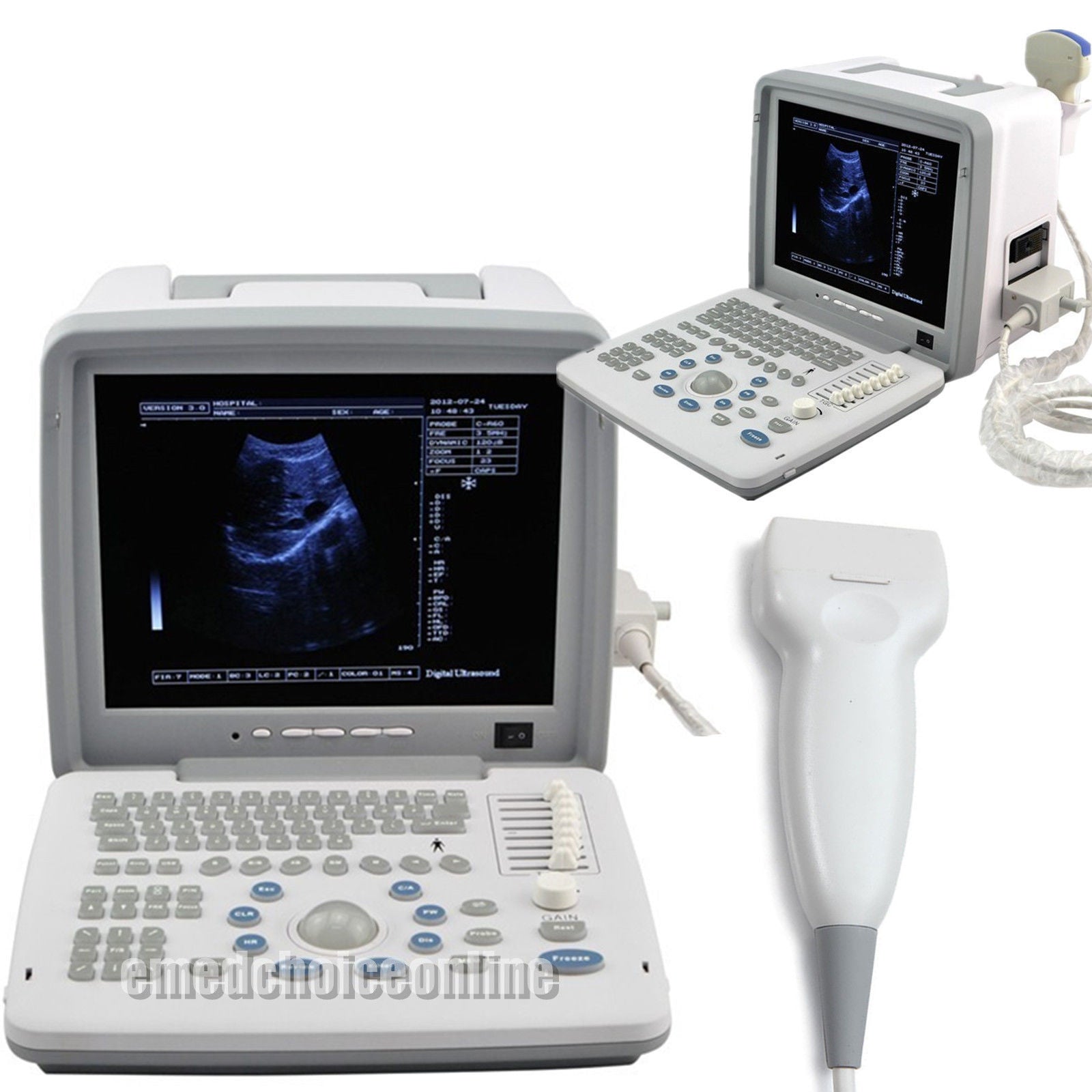 Portable Medical Ultrasound Scanner/Machine 7.5MHz Linear Probe Free 3D CE Sale DIAGNOSTIC ULTRASOUND MACHINES FOR SALE