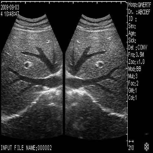 Diagnostic Ultrasound Scanner System Machine Convex +Transvaginal Probe 3D Image 190891665560 DIAGNOSTIC ULTRASOUND MACHINES FOR SALE