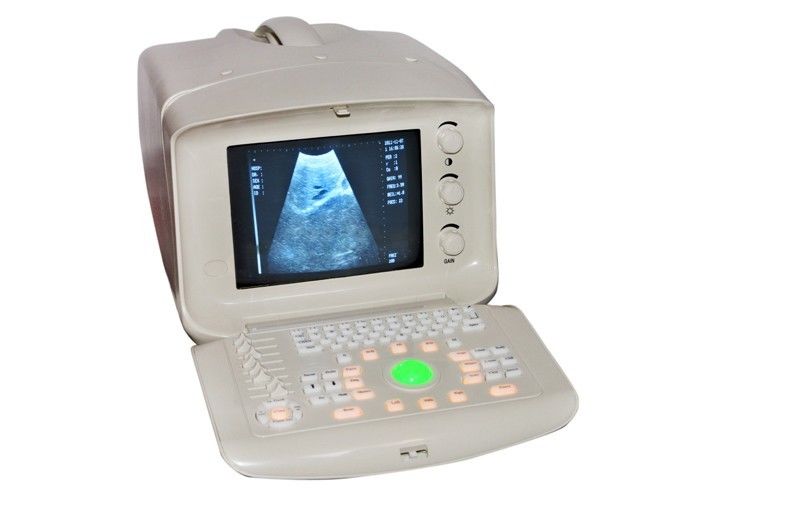 Hot Digital Diagnose Ultrasound Scanner Machine with Convex Probe +3D Software 190891792440 DIAGNOSTIC ULTRASOUND MACHINES FOR SALE