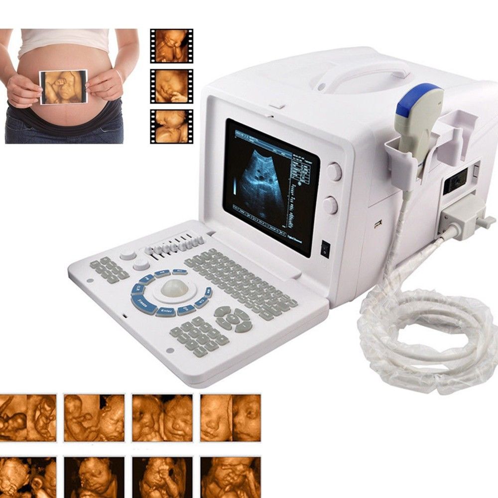 New Digital Ultrasound machine Scanner System Convex + linear Probe +3D Recorder DIAGNOSTIC ULTRASOUND MACHINES FOR SALE