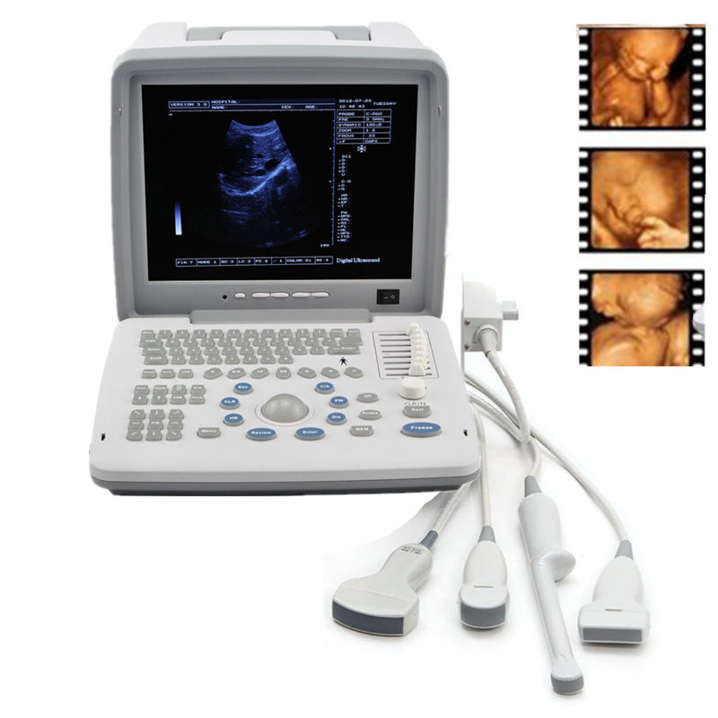 Portable Ultrasound Machine Scanner Convex Linear Endovaginal Micro 4 PROBE+3D DIAGNOSTIC ULTRASOUND MACHINES FOR SALE