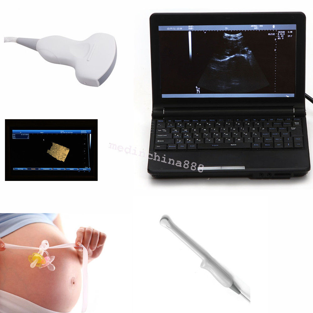 Portable LCD Digital 10.1-Inch Ultrasound Scanner + Convex+Transvaginal Probe 190891247261 DIAGNOSTIC ULTRASOUND MACHINES FOR SALE