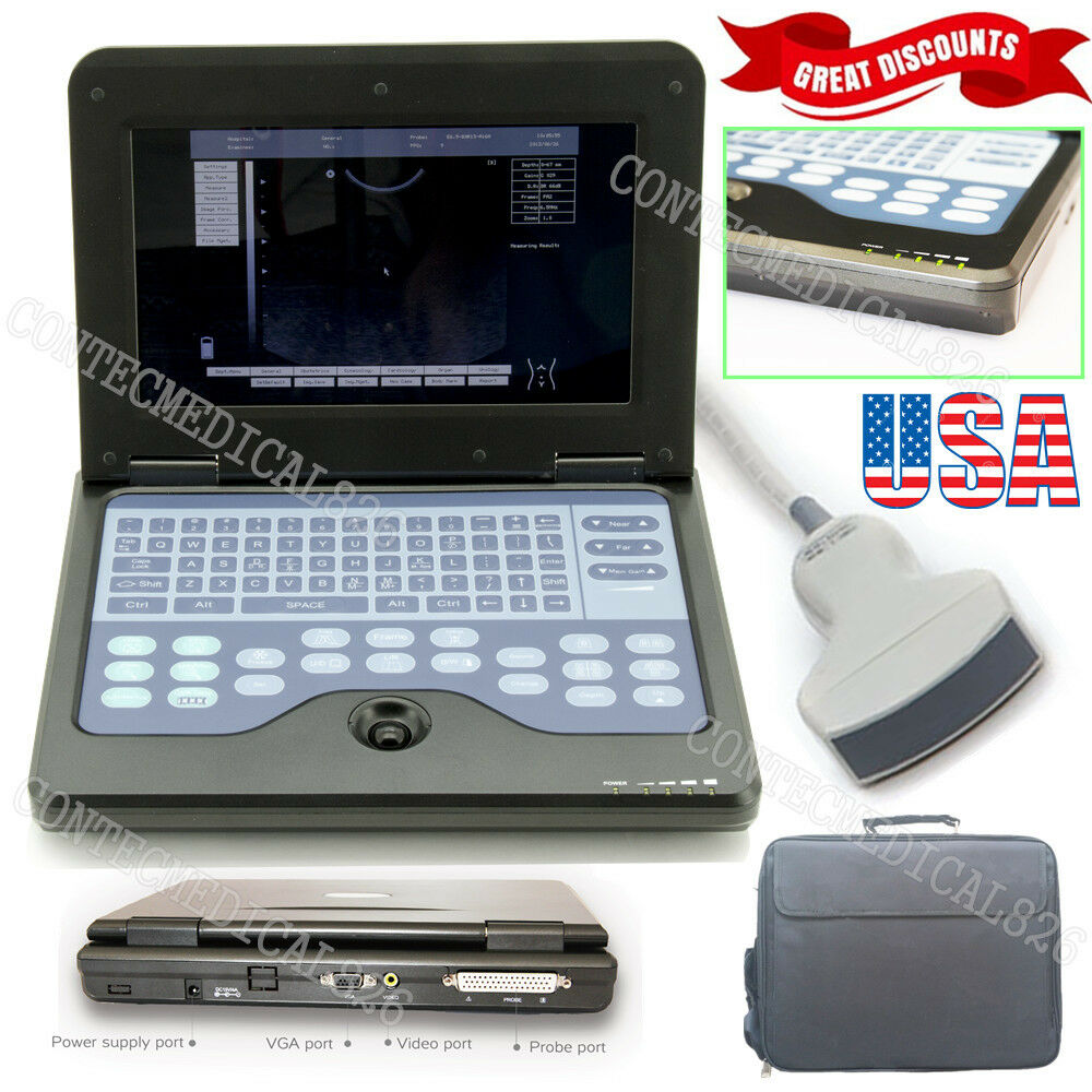 USA Seller,Digital Ultrasound Scanner Portable Laptop Ultrasound Machine+Convex DIAGNOSTIC ULTRASOUND MACHINES FOR SALE