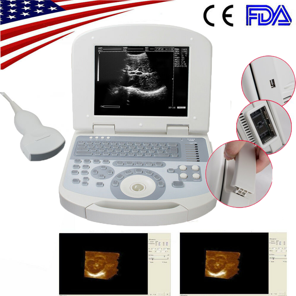 USA Portable Full Digital Laptop Medical Ultrasound Scanner+3.5mhz Convex probe DIAGNOSTIC ULTRASOUND MACHINES FOR SALE