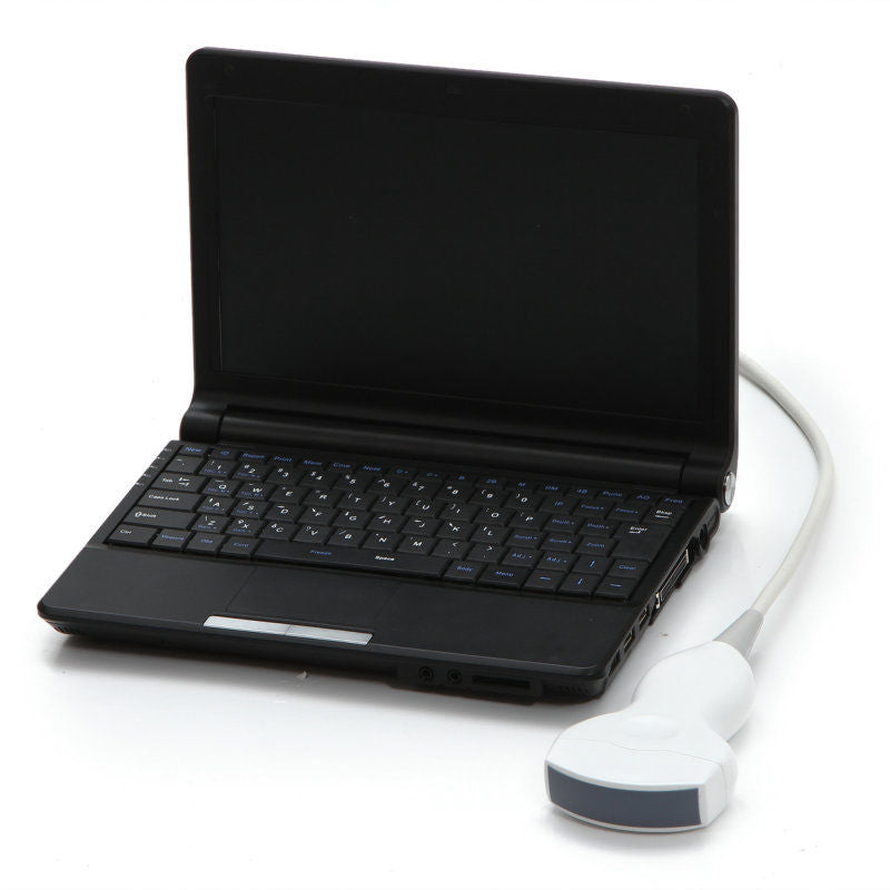 External 3D Digital Laptop Ultrasound Scanner With 7.5MHz Linear Probe 10"LCD CE DIAGNOSTIC ULTRASOUND MACHINES FOR SALE