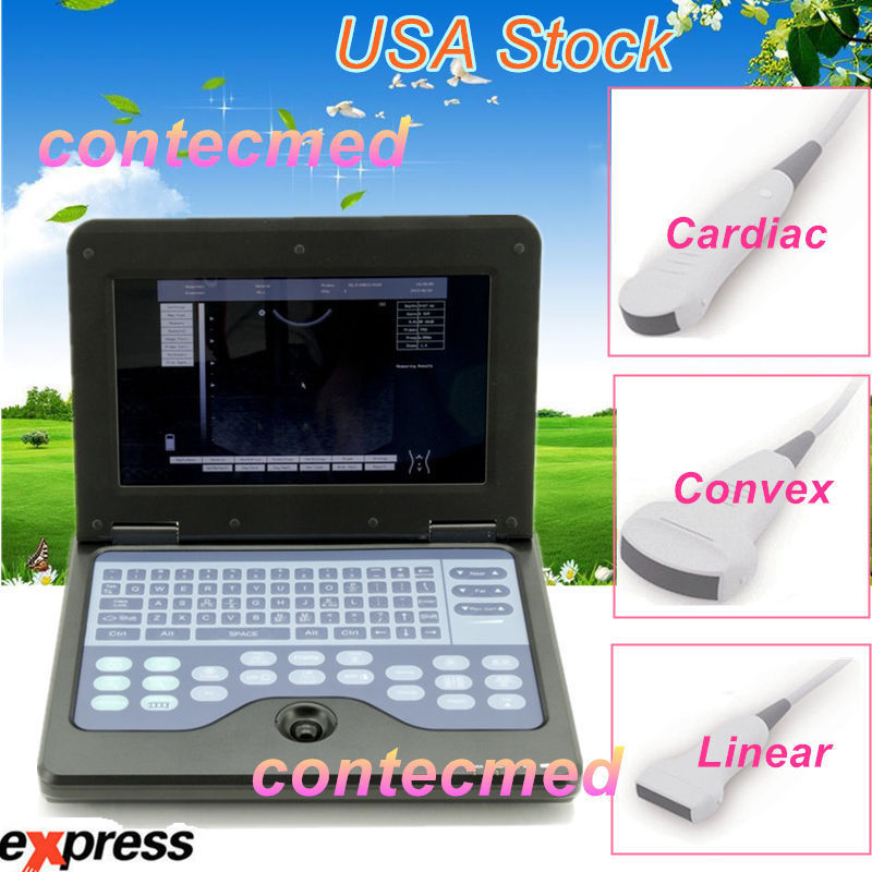 CE Portable Ultrasound Scanner Machine Laptop Diagnostic System(4 Probes Option) DIAGNOSTIC ULTRASOUND MACHINES FOR SALE