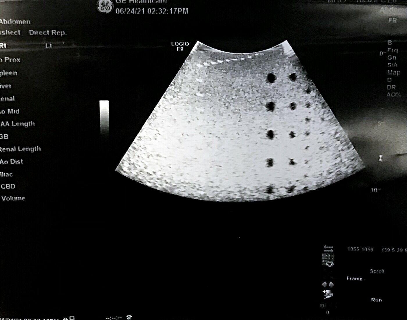 GE C1-6VN-D Curved Array Ultrasound Transducer Probe DIAGNOSTIC ULTRASOUND MACHINES FOR SALE