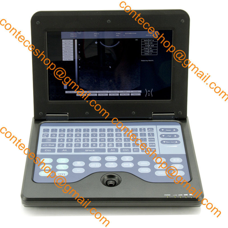 VET Veterinary portable Ultrasound Scanner Machine+2 Probes,Cow/Horse/Dog/Cat,US 658126923446 DIAGNOSTIC ULTRASOUND MACHINES FOR SALE