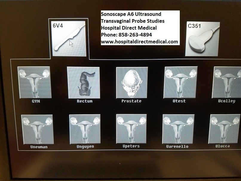 Sonoscape A6 Portable OBGYN Ultrasound with 2 Transducers DIAGNOSTIC ULTRASOUND MACHINES FOR SALE