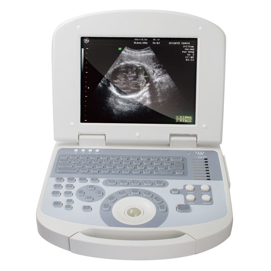 USA Ultrasound Scanner PC Scan Hi-Definition 3D Digital Scanner +Convex Probe 190891402028 DIAGNOSTIC ULTRASOUND MACHINES FOR SALE