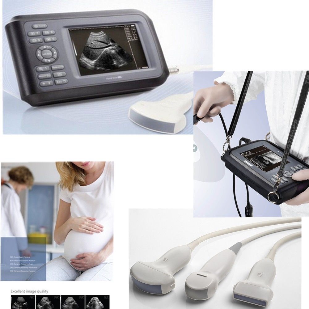 Laptop Machine HandScan Ultrasound scanner Convex +Linear+ Cardiac Heart 3 Probe 190891048707 DIAGNOSTIC ULTRASOUND MACHINES FOR SALE