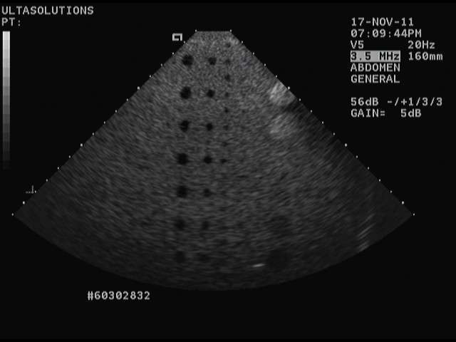 Acuson V5 with Pins Ultrasound Probe DIAGNOSTIC ULTRASOUND MACHINES FOR SALE