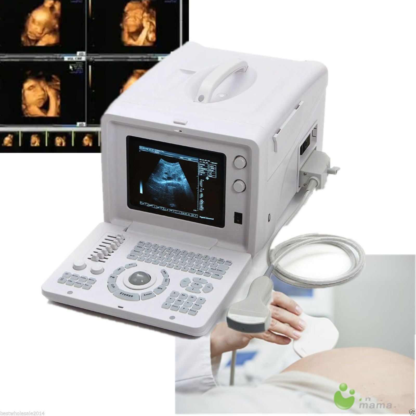 Diagnostic Machine Type B Ultrasound Scanner 3.5 Mhz Convex Curved Probe DIAGNOSTIC ULTRASOUND MACHINES FOR SALE