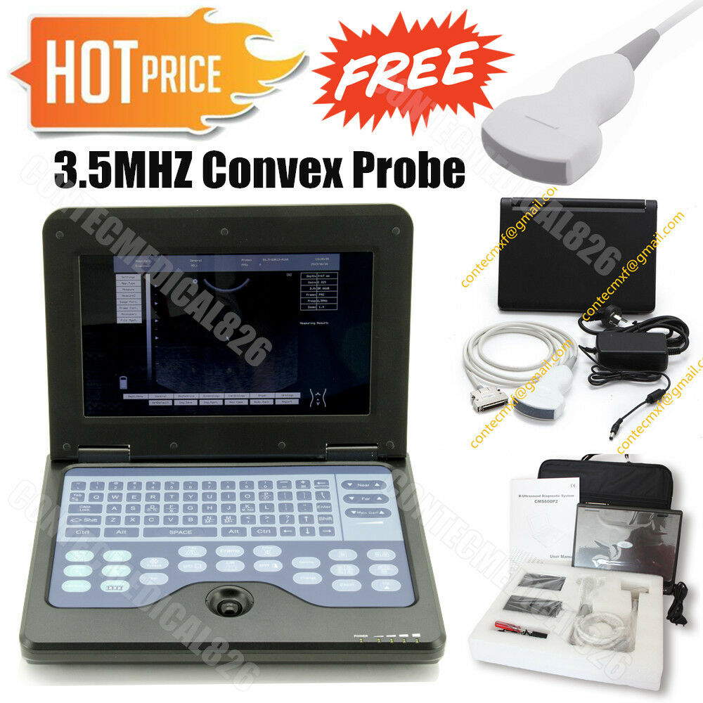 Portable laptop machine LCD Digital Ultrasound scanner with 3.5 Convex probe,USA 6945040100362 DIAGNOSTIC ULTRASOUND MACHINES FOR SALE