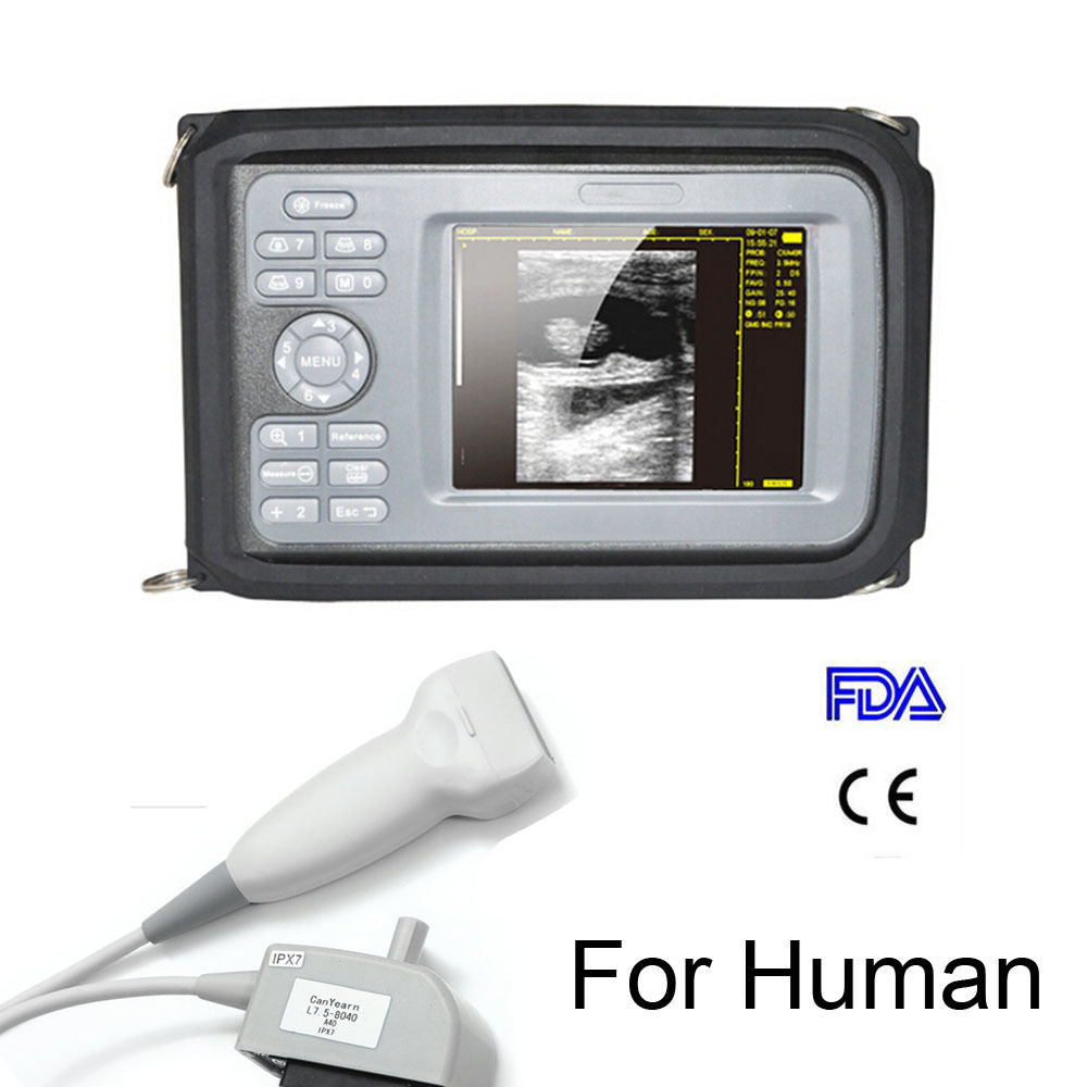 5.5" TFT Human Portable Handheld Digital Ultrasound Scanner 7.5Mhz Linear probe DIAGNOSTIC ULTRASOUND MACHINES FOR SALE