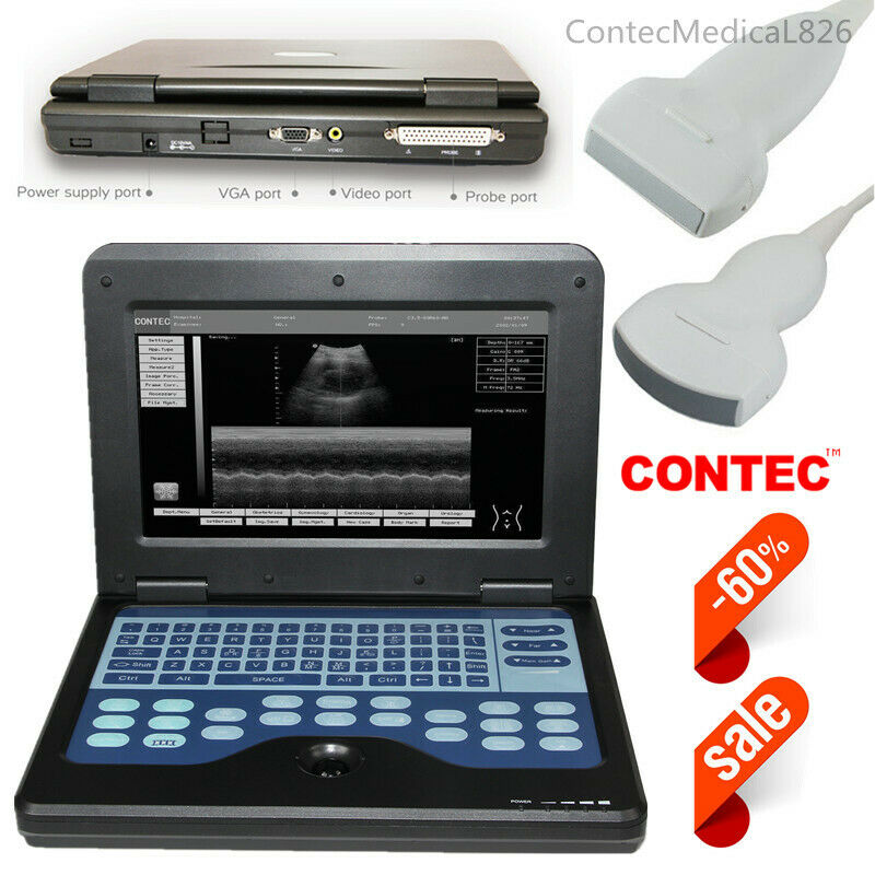 USA Digial Ultrasound Scanner Laptop Ultrasound Machine Convex Linear 2 Probes DIAGNOSTIC ULTRASOUND MACHINES FOR SALE