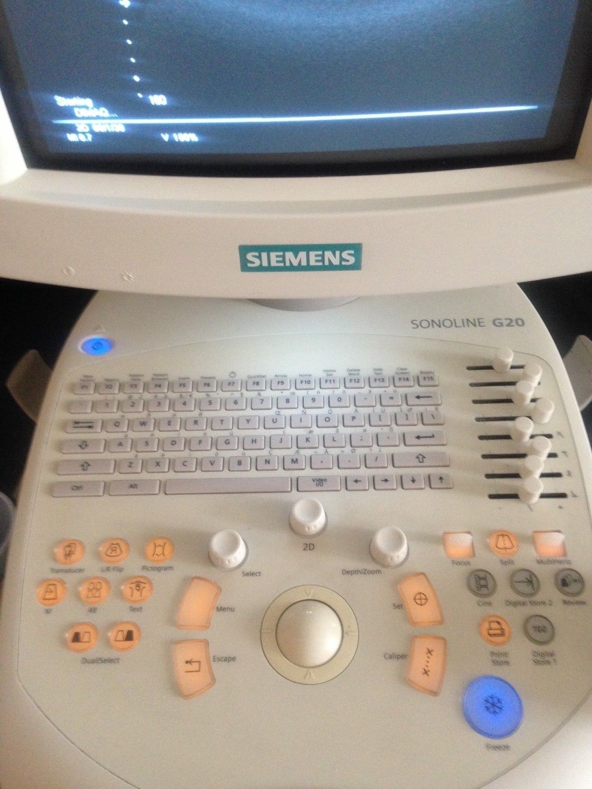 Siemens Sonoline G20 Ultrasound  C5-2 Probe  & Printer  OB-GYN, Urology DIAGNOSTIC ULTRASOUND MACHINES FOR SALE