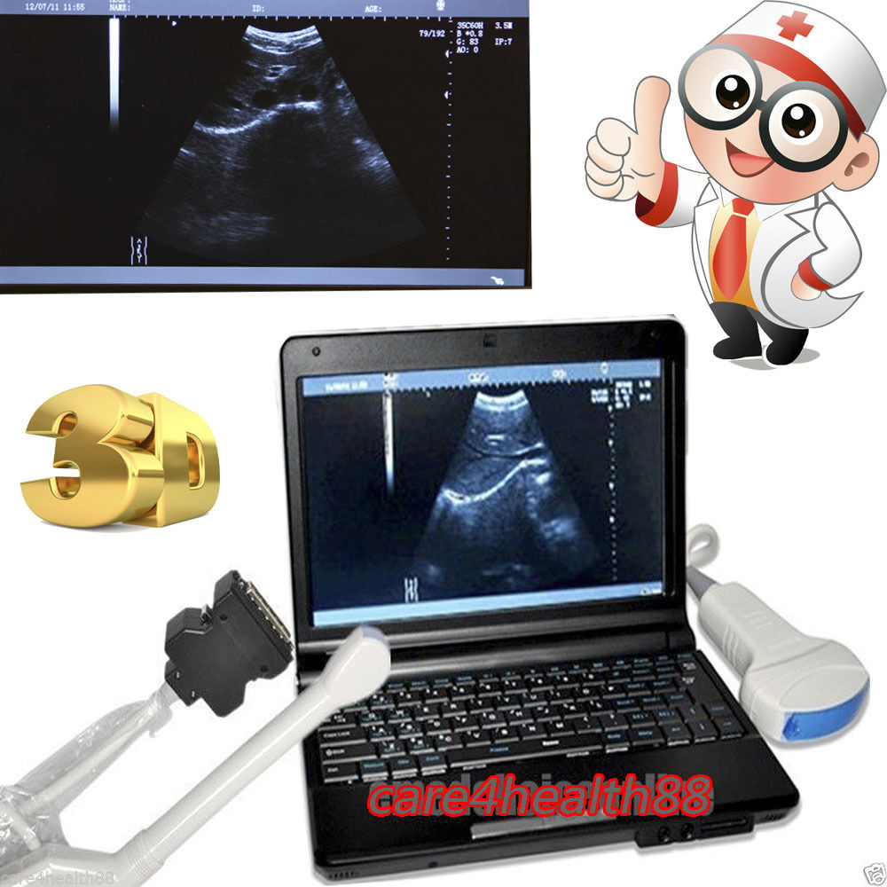 CE Laptop Portable Digital Ultrasound Machine Scanner Convex +Transvaginal Probe DIAGNOSTIC ULTRASOUND MACHINES FOR SALE