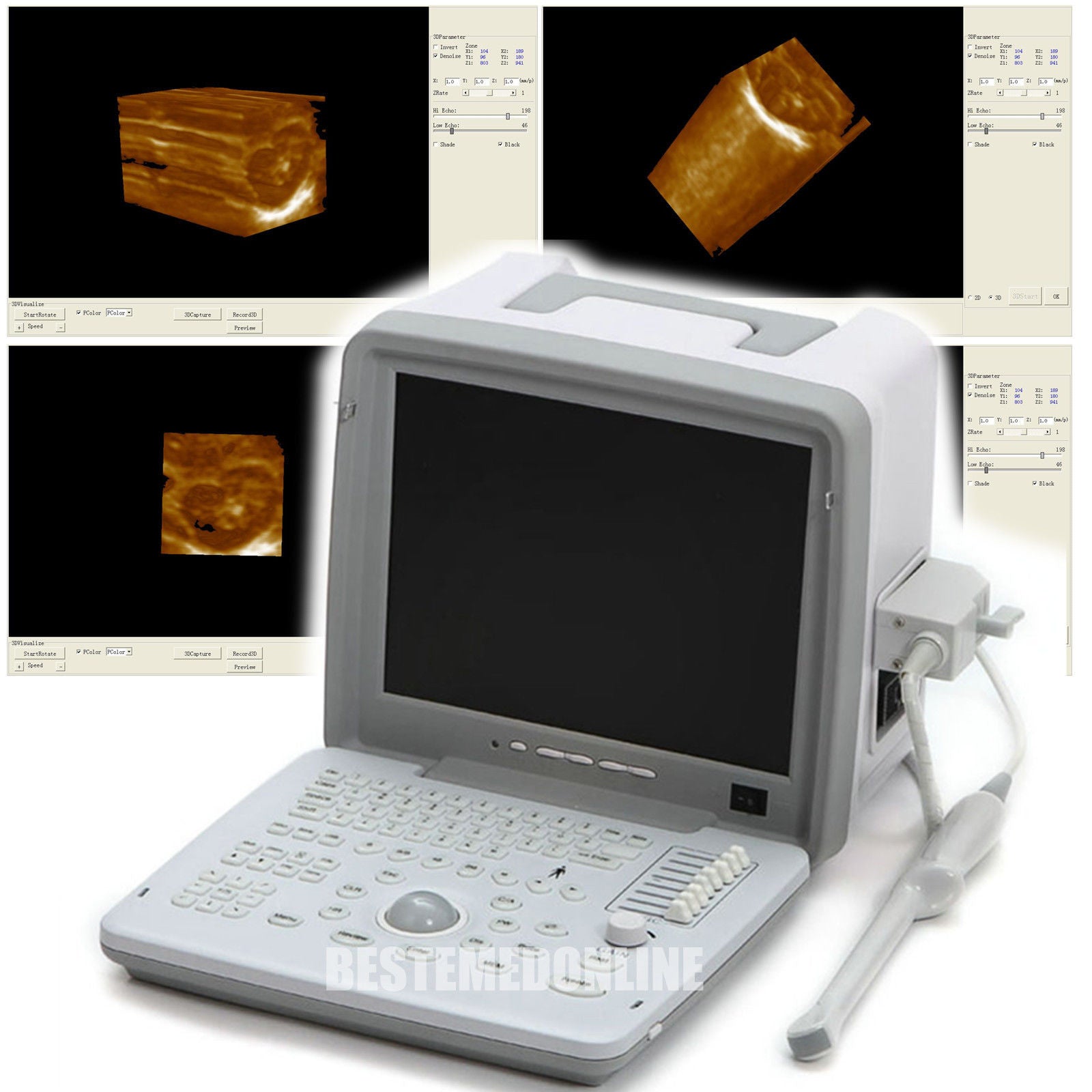 Clinic 12"LCD Full Digital Ultrasound Scanner +Transvaginal Probe+3D Clear Image 190891976581 DIAGNOSTIC ULTRASOUND MACHINES FOR SALE