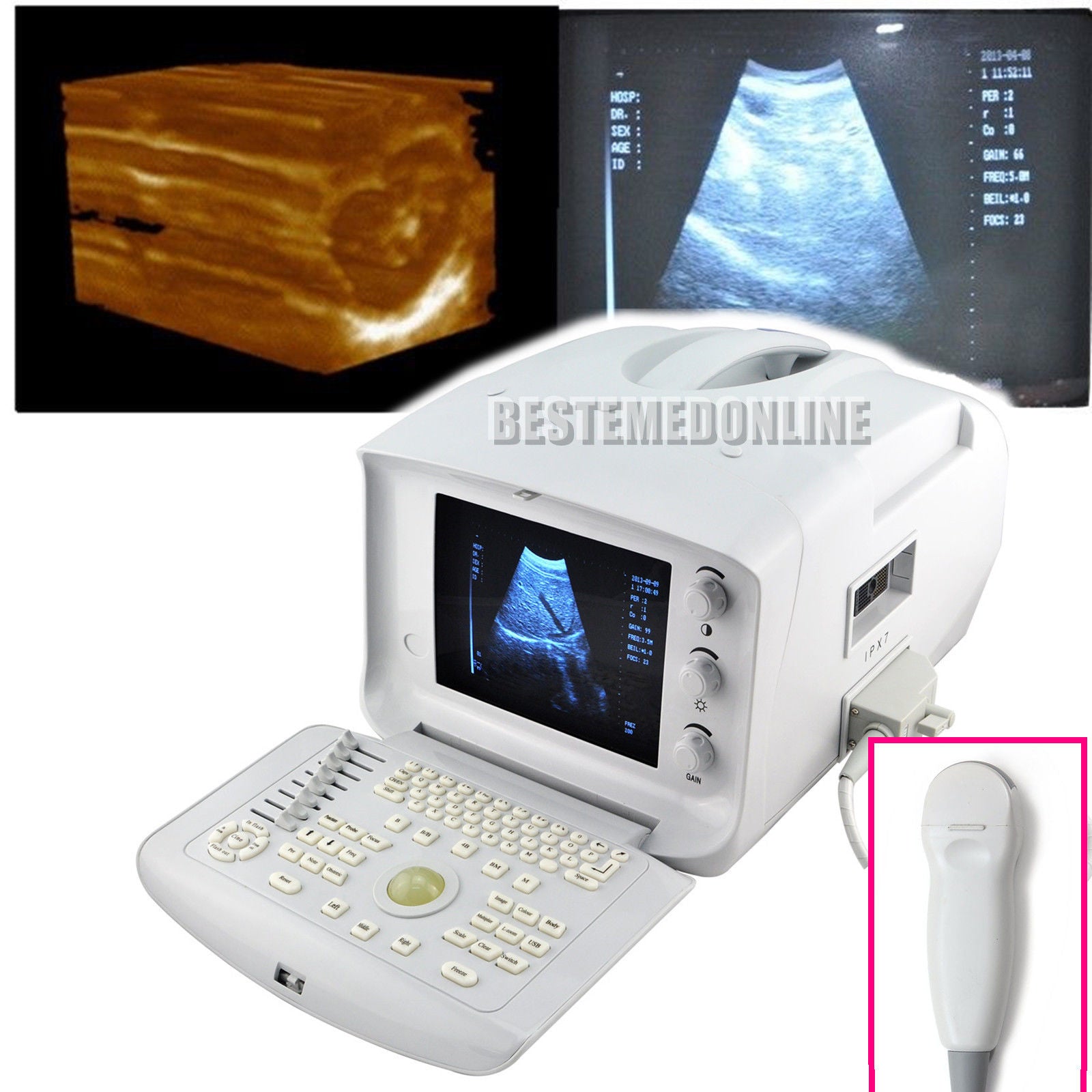 Protable Ultrasound Scanner Micro-Convex Probe Ultrasonic Machine 3 d ultrasound DIAGNOSTIC ULTRASOUND MACHINES FOR SALE