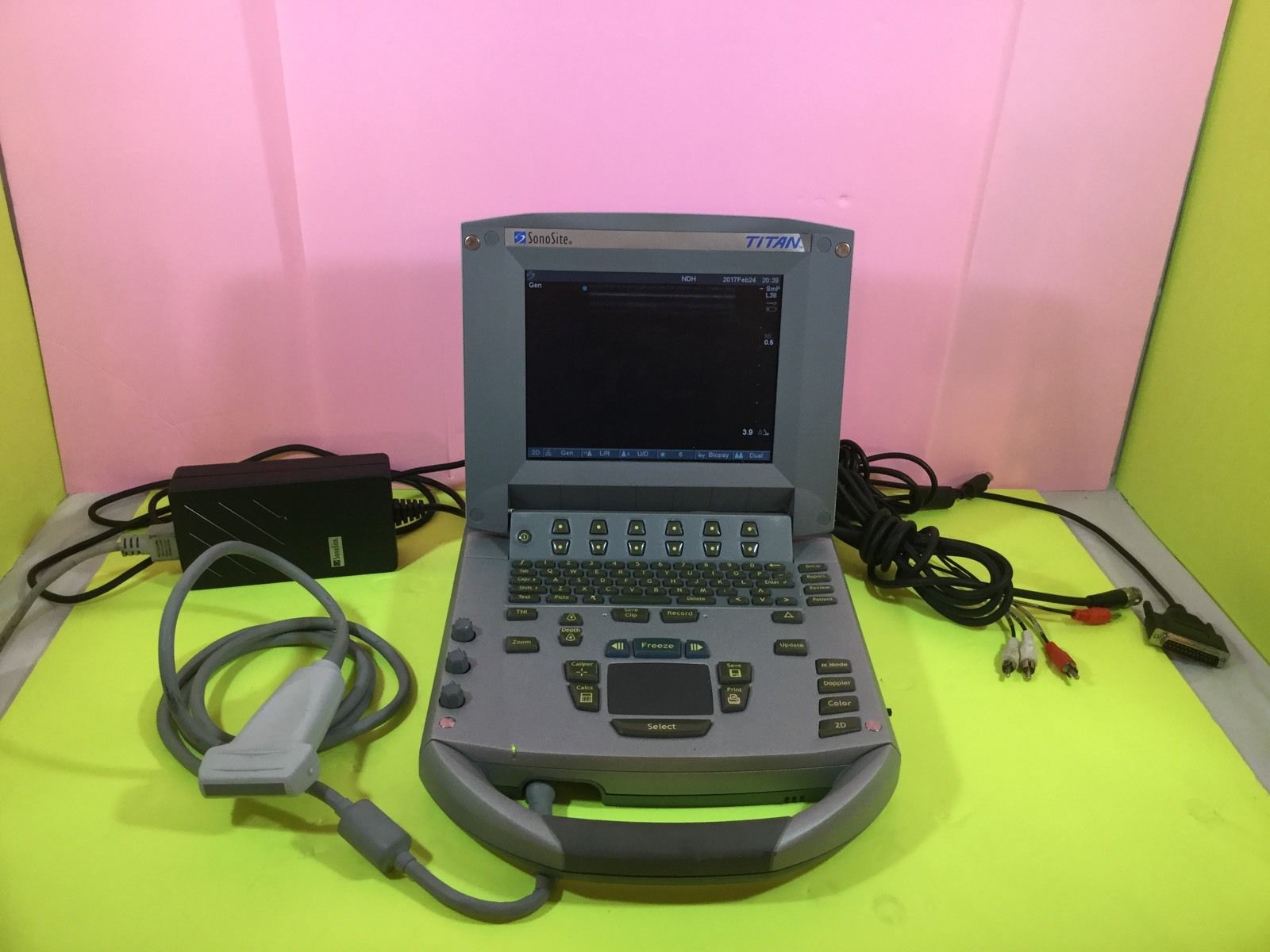 SONOSITE TITAN Portable Ultrasound with C15/4-2 and L38/10-5 Transducers DIAGNOSTIC ULTRASOUND MACHINES FOR SALE