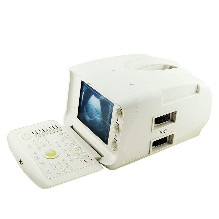 Digital Ultrasound Scanner Machine System Convex  Linear Probe/Transducer 3D DIAGNOSTIC ULTRASOUND MACHINES FOR SALE