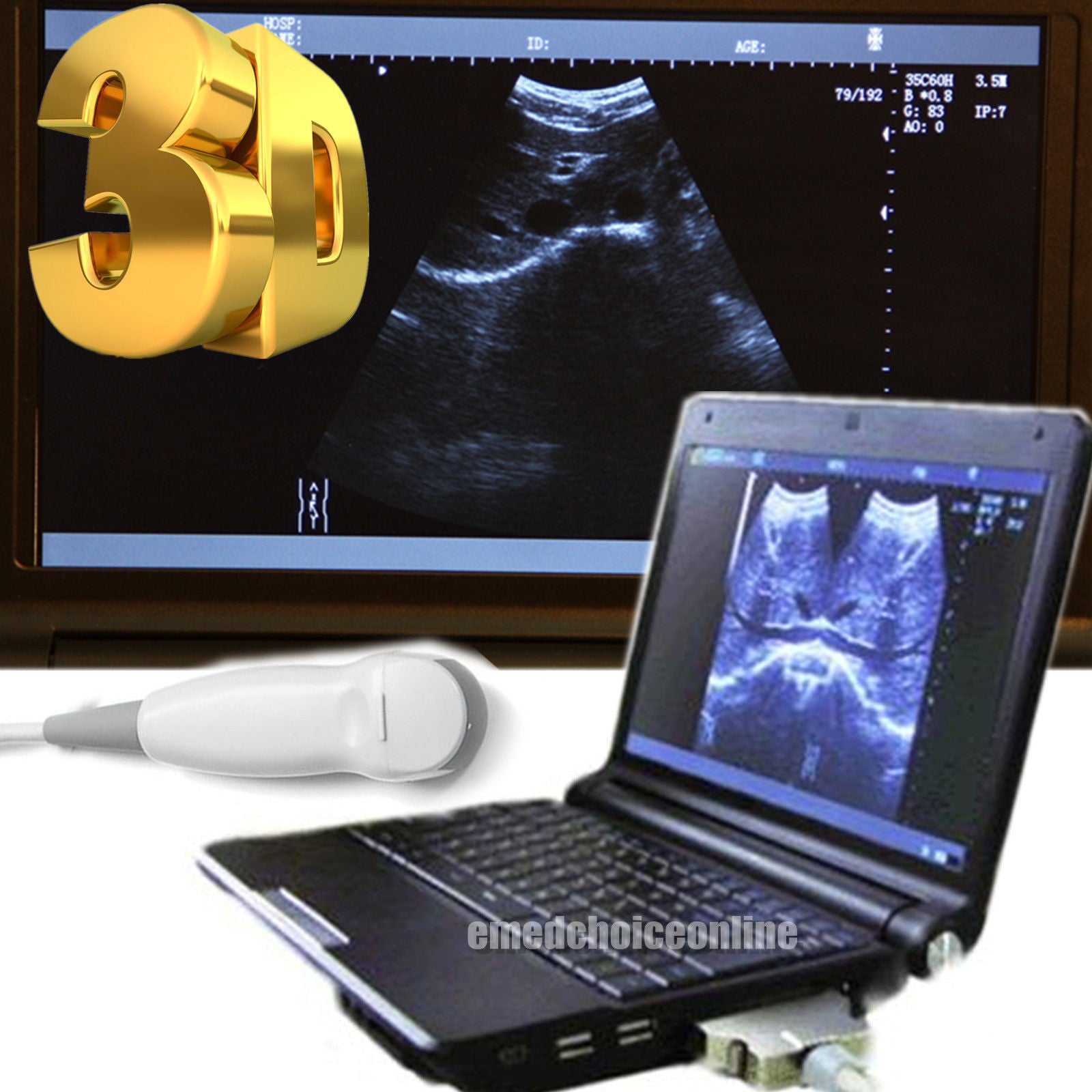 Hot Laptop/Notebook Ultrasound Scanner/ Machine+ Micro-Convex Probe+3D Version 190891867179 DIAGNOSTIC ULTRASOUND MACHINES FOR SALE