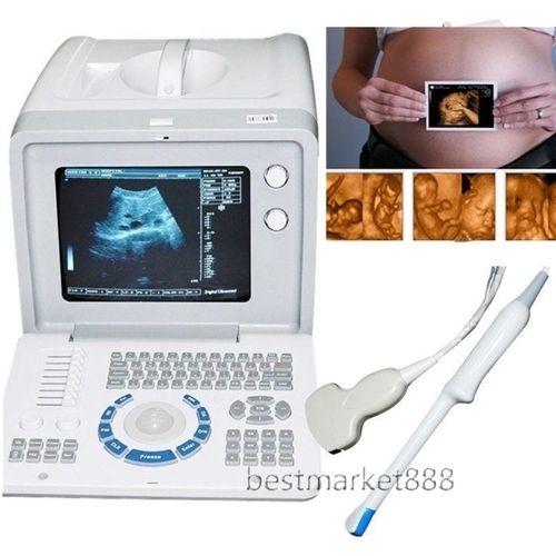 Portable Digital Ultrasound Scanner Ultrasonic System+Convex +Linear 2 Probes 3D DIAGNOSTIC ULTRASOUND MACHINES FOR SALE