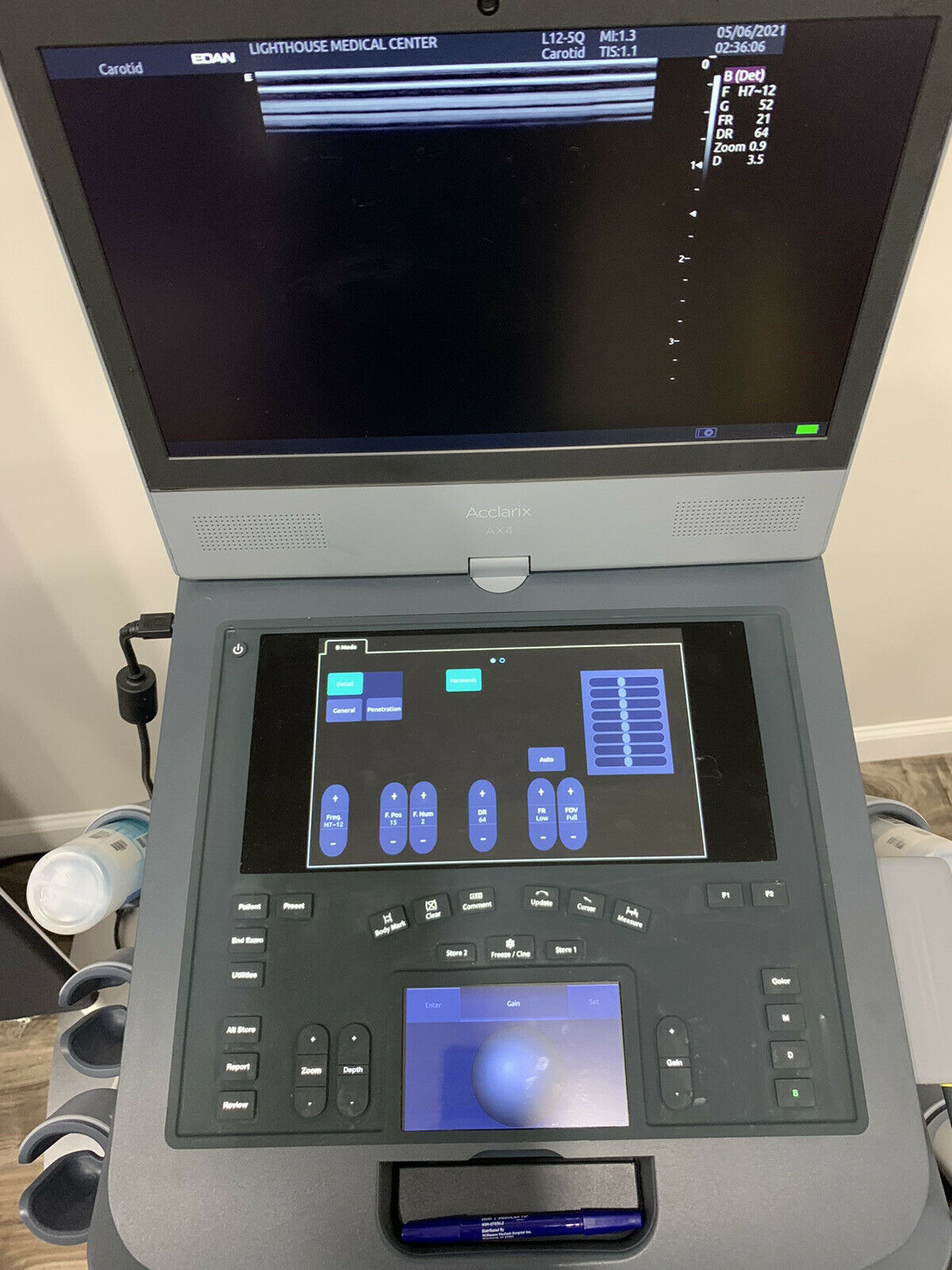 EDAN Acclarix AX4 Ultrasound DIAGNOSTIC ULTRASOUND MACHINES FOR SALE