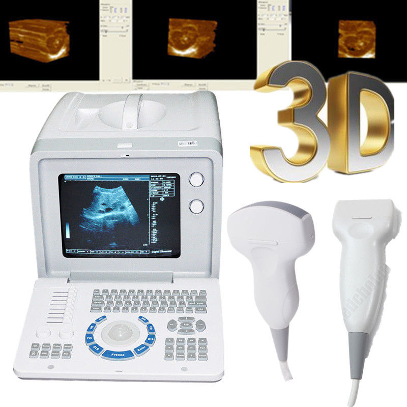 Portable Digital Ultrasound Scanner Machine 3.5MHZ Convex 7.5mhz