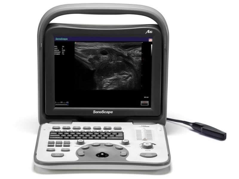 SonoScape A6V Portable Veterinary Ultrasound With 2 Probes: Rectal, Micro Convex DIAGNOSTIC ULTRASOUND MACHINES FOR SALE