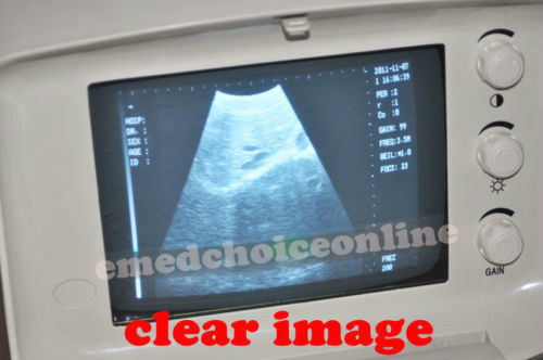 Portable Machine Digital Ultrasound Scanner Transvaginal Probe -PC 3D Software 190891732514 DIAGNOSTIC ULTRASOUND MACHINES FOR SALE