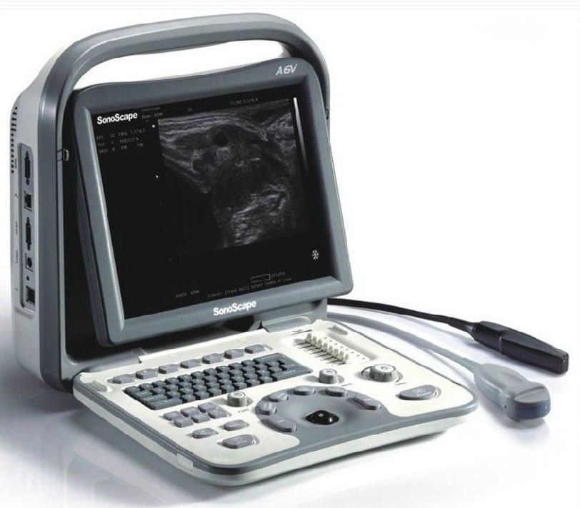 SonoScape A6V Veterinary Ultrasound Scanner - Convex Probe 5-9MHz, Trolley, Bag DIAGNOSTIC ULTRASOUND MACHINES FOR SALE